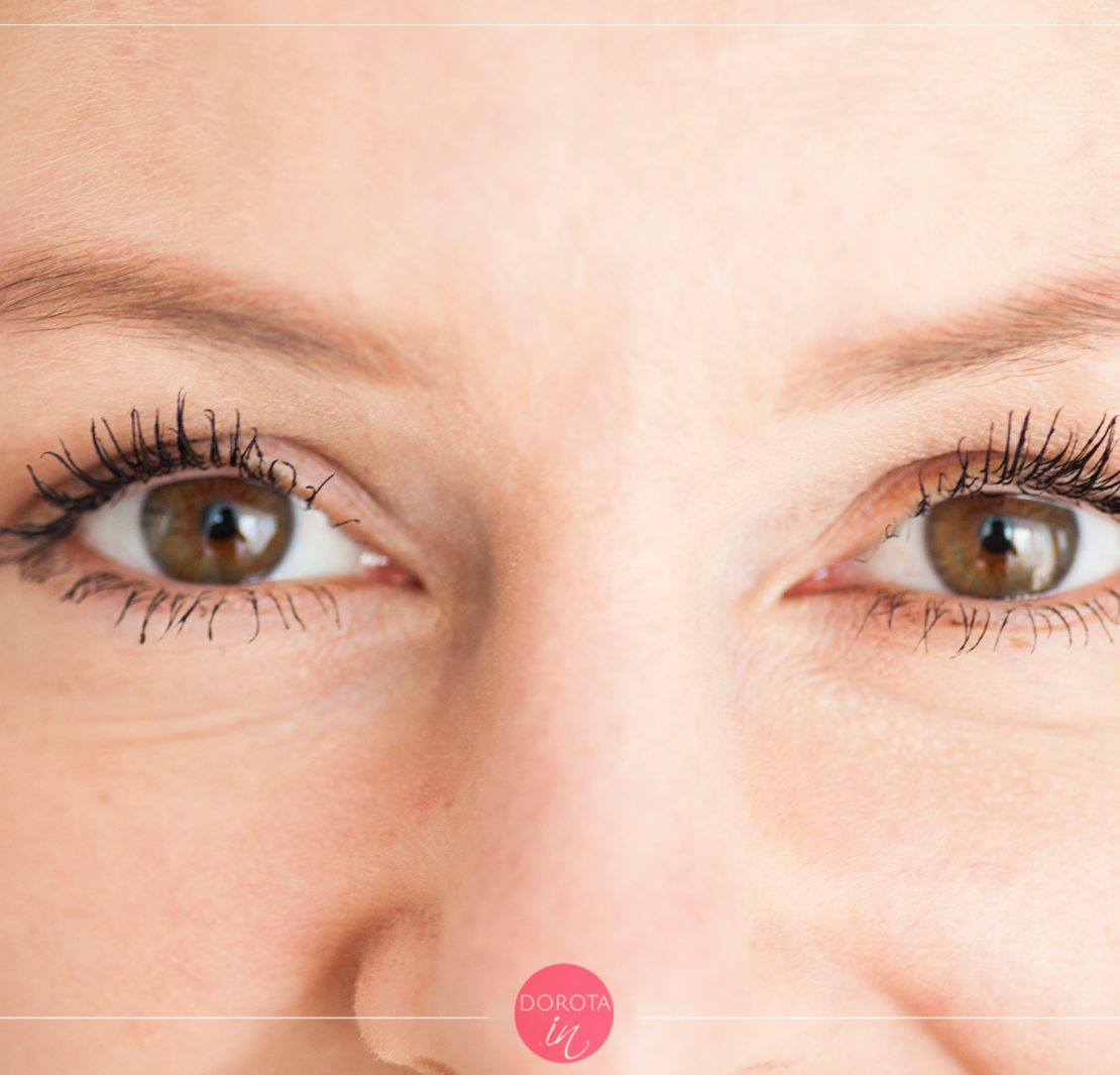 Plexr - alternatywa chirurgii plastycznej powiek